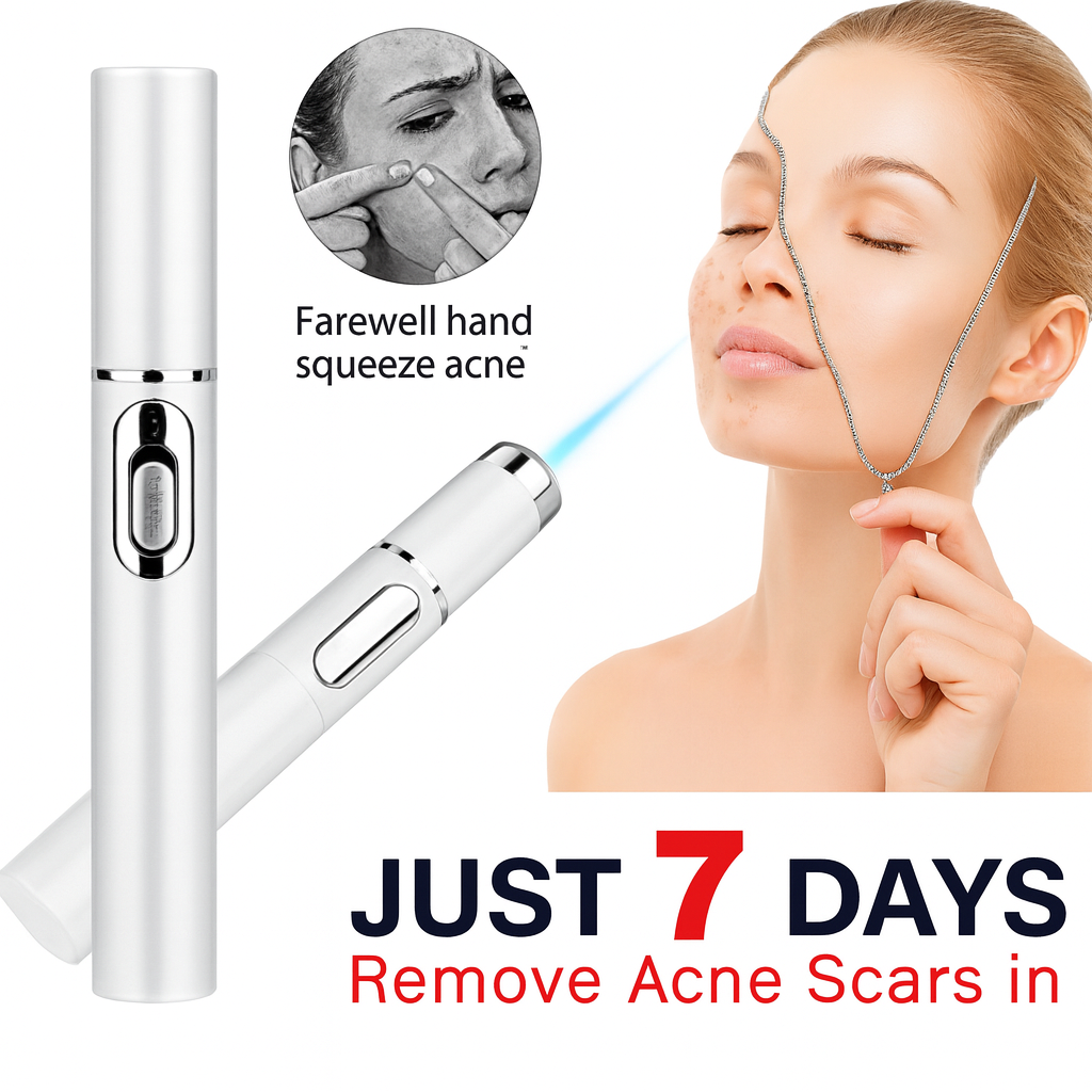 Bealuva Blue Light Therapy Acne & Wrinkle Removal Pen