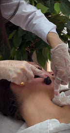 Microneedling Roller Kit For Skin And Hair